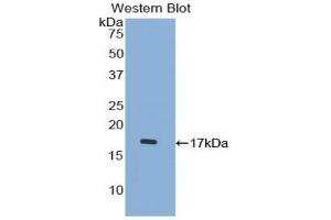 Detection of Recombinant PCT, Human using Polyclonal Antibody to Procalcitonin (PCT) (Procalcitonin anticorps  (AA 26-141))