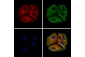 Transferrin Antibody staining Hela cells by IF/ICC. (Transferrin anticorps  (Internal Region))