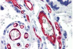 Human Placenta (formalin-fixed, paraffin-embedded) stained with CD34 antibody ABIN239805 at 10 ug/ml followed by biotinylated anti-mouse IgG secondary antibody ABIN481714, alkaline phosphatase-streptavidin and chromogen. (CD34 anticorps)