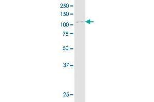 CTNND2 monoclonal antibody (M01), clone 6E11.