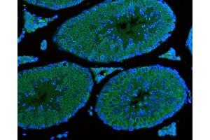 IF analysis of DDX4/MVH using anti-DDX4/MVH antibody (ABIN7601204). (DDX4 anticorps  (AA 3-666))
