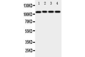 Anti-ADAM19 antibody, Western blotting Lane 1: Rat Spleen Tissue Lysate Lane 2: Rat Intestine Tissue Lysate Lane 3: Rat Brain Tissue Lysate Lane 4: HELA Cell Lysate (ADAM19 anticorps  (N-Term))