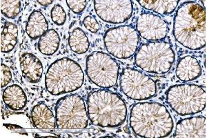 IHC analysis of SNAP23 using anti-SNAP23 antibody (ABIN7603236). (SNAP23 anticorps  (N-Term))