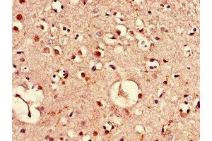 Immunohistochemistry of paraffin-embedded human brain tissue using ABIN7169149 at dilution of 1:100 (PIM3 anticorps  (AA 278-326))