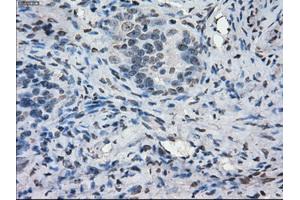 Immunohistochemical staining of paraffin-embedded colon tissue using anti-PORmouse monoclonal antibody. (POR anticorps)