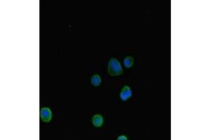 Immunofluorescent analysis of MCF-7 cells using ABIN7144657 at dilution of 1:100 and Alexa Fluor 488-congugated AffiniPure Goat Anti-Rabbit IgG(H+L) (Aryl Hydrocarbon Receptor anticorps  (AA 126-353))