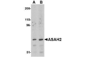 Western blot analysis of ASAH2 in 293 cell lysate with AP30083PU-N ASAH2 antibody at (A) 1 and (B) 2 μg/ml. (ASAH2 anticorps  (C-Term))