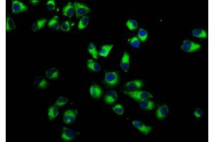 Immunofluorescence staining of Hela cells with ABIN7156450 at 1:233, counter-stained with DAPI. (ITGA7 anticorps  (AA 175-283))