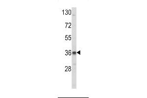 Western blot analysis of LDLR Antibody (N-term) (ABIN392553 and ABIN2842100) in K562 cell line lysates (35 μg/lane).