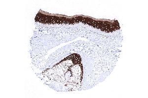 skin hairfollicel and sebaceous glands