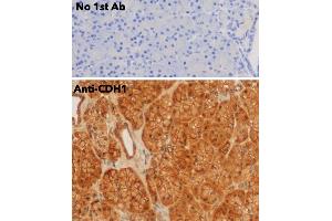 Immunohistochemistry (IHC) image for anti-Cadherin 1, Type 1, E-Cadherin (Epithelial) (CDH1) antibody (ABIN6254215)