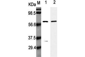 Western Blot analysis using anti-Listeria monocytogenes, mAb (P6007)  at 1:5000 dilution. (Listeria Monocytogenes, P60 anticorps)