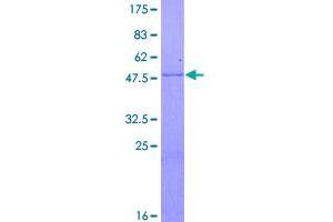Image no. 1 for Folate Receptor 1 (Adult) (FOLR1) (AA 1-257) protein (GST tag) (ABIN1354298)