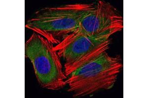 Immunofluorescence analysis of HepG2 cells using UBE2I mouse mAb (green).