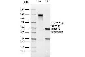SDS-PAGE Analysis Purified MALT1 Recombinant Mouse Monoclonal Antibody (rMT1/410). (Recombinant MALT1 anticorps  (AA 701-808))