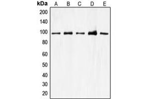 Western blot analysis of CDC27 expression in A549 (A), K562 (B), Jurkat (C), HEK293T (D), HeLa (E) whole cell lysates. (CDC27 anticorps  (Center))