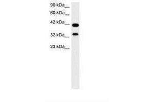 Image no. 2 for anti-Paired Box Gene 2a (PAX2A) (AA 174-223) antibody (ABIN202997) (PAX2A anticorps  (AA 174-223))