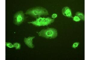 Detection of NQO1 in A549 cells using Polyclonal Antibody to NADH Dehydrogenase, Quinone 1 (NQO1)