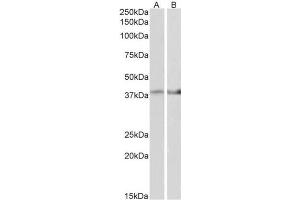 AP31421PU-N IDH3B antibody staining of Mouse Heart (A) and Mouse Muscle (B) lysate at 2 µg/ml (35µg protein in RIPA buffer). (IDH3B anticorps  (AA 33-46))