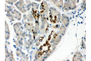 Anti- PAX6 Picoband antibody, IHC(P) IHC(P): Human Pancreatic Cancer Tissue (PAX6 anticorps  (Middle Region))
