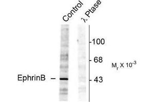 Image no. 1 for anti-Ephrin B1 (EFNB1) (pTyr298) antibody (ABIN372619) (Ephrin B1 anticorps  (pTyr298))