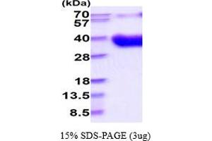 SDS-PAGE (SDS) image for CD80 (CD80) (AA 37-246) (Active) protein (His tag) (ABIN5854584)