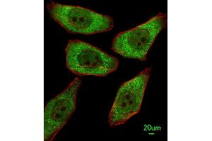 Immunofluorescent analysis of A549 cells, using FDPS Antibody (N-term) (ABIN1882080 and ABIN2839262).