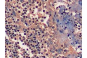 Detection of EGFR in Human Tonsil Tissue using Polyclonal Antibody to Epidermal Growth Factor Receptor (EGFR)