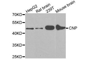 Western blot analysis of extracts of various cell lines, using CNP antibody.