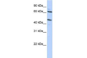 WB Suggested Anti-SLC26A10 Antibody Titration:  0. (SLC26A10 anticorps  (N-Term))