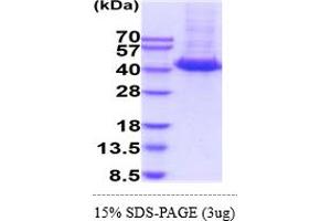 SDS-PAGE (SDS) image for Interleukin 3 Receptor, alpha (IL3RA) (AA 20-305) protein (His tag) (ABIN6388144)