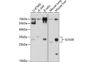 Western blot analysis of extracts of various cell lines, using SCN3B antibody (ABIN6133255, ABIN6147441, ABIN6147442 and ABIN6214525) at 1:1000 dilution.