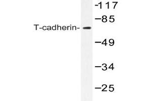 Image no. 1 for anti-Cadherin 13 (CDH13) antibody (ABIN272293) (Cadherin 13 anticorps)