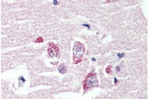 Anti-GPR98 antibody  ABIN1048902 IHC staining of human brain, cortex.