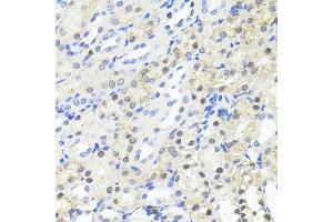 Immunohistochemistry of paraffin-embedded Mouse kidney using TRIM27 antibody (ABIN7269922) at dilution of 1:100 (40x lens). (TRIM27 anticorps  (AA 1-200))