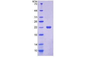 SDS-PAGE analysis of Human DKC Protein. (DKC1 Protéine)