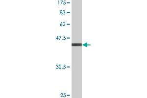 Western Blot detection against Immunogen (37. (Retinoic Acid Receptor alpha anticorps  (AA 315-424))