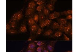 Immunofluorescence analysis of C6 cells using ACBD3 Polyclonal Antibody at dilution of 1:100. (ACBD3 anticorps)