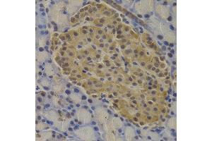 Immunohistochemistry of paraffin-embedded rat pancreas using MECOM antibody at dilution of 1:200 (400x lens).