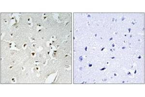 Immunohistochemistry analysis of paraffin-embedded human brain, using PMS1 Antibody. (PMS1 anticorps  (AA 441-490))