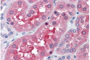 Human Kidney: Formalin-Fixed, Paraffin-Embedded (FFPE)