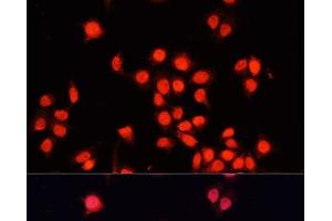 Immunofluorescence analysis of HeLa cells using BACH1 Polyclonal Antibody at dilution of 1:100.