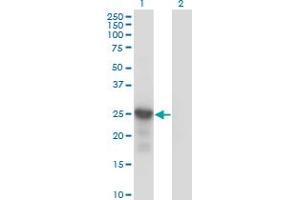 Western Blot analysis of CDKN1B expression in transfected 293T cell line by CDKN1B monoclonal antibody (M01), clone 4B4-E6.