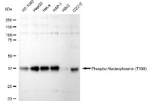 Western blotting analysis using Phospho-Nucleophosmin (T199) antibody (ABIN7799673).
