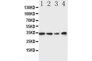 Anti-MyD88 antibody, Western blotting Lane 1: Rat Spleen Tissue Lysate Lane 2: Rat Thymus Tissue Lysate Lane 3: JURKAT Cell Lysate Lane 4: RAJI Cell Lysate (MYD88 anticorps  (Middle Region))