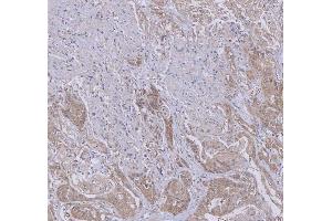 IHC analysis of WDR44 using anti-WDR44 antibody (ABIN7600394). (WDR44 anticorps  (AA 188-913))
