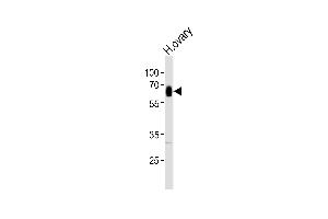 Western blot analysis of lysate from human ovary tissue, using CYP3A4 Antibody at 1:1000.