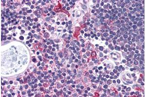 Human Thymus (formalin-fixed, paraffin-embedded) stained with CHEK1 antibody ABIN214737 at 5 ug/ml followed by biotinylated goat anti-rabbit IgG secondary antibody ABIN481713, alkaline phosphatase-streptavidin and chromogen.