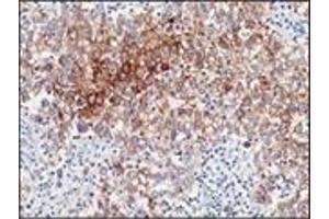 Immunohistochemistry (IHC) image for anti-Placental Alkaline Phosphatase (ALPP) antibody (ABIN870413) (PLAP anticorps)
