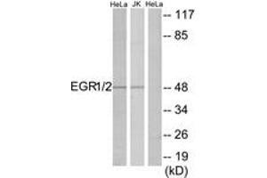 anti-EGR1 + EGR2 (AA 371-420) antibody